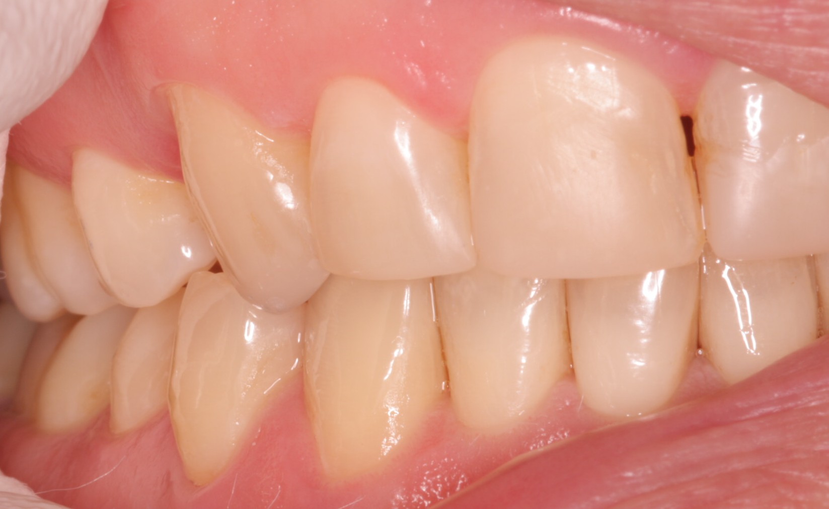Z2 Beechwood Dental_best dentist Dublin